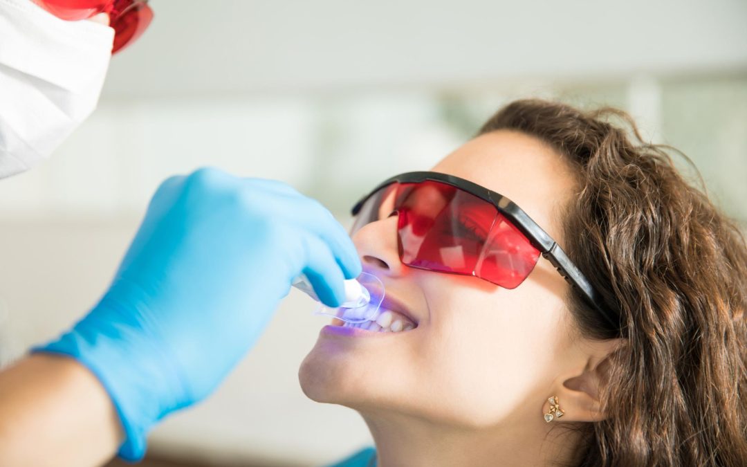 How Professional Teeth Whitening Works—and Why At-Home Kits Fall Short
